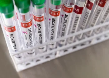 Palermo: negativo al vaiolo delle scimmie anche il 30enne marocchino