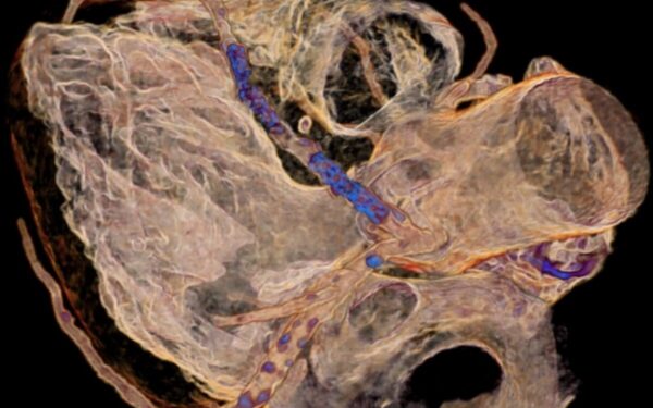 Prevenire i rischi dell’infarto: a Messina arriva un nuovo finanziamento