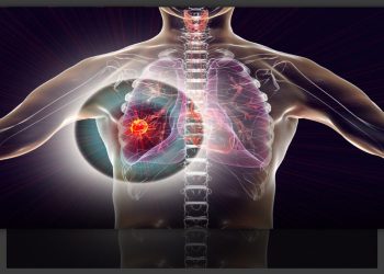 Tumori: Italia prima in Ue per calo delle morti