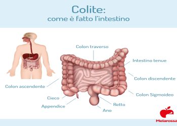 Colite nervosa, quanti italiani ne soffrono attualmente?