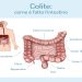 Colite nervosa, quanti italiani ne soffrono attualmente?