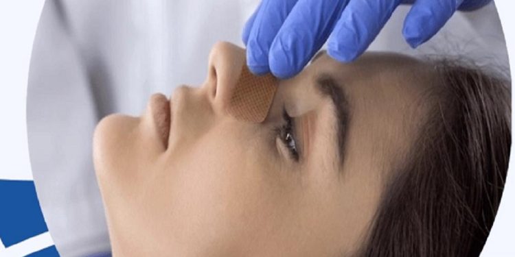 In Italia si eseguono più rinoplastiche che negli Stati Uniti. Tecniche più personalizzate e sicure: le 5 cose da sapere prima di operarsi